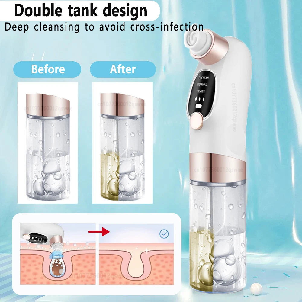 Blackhead Remover Vacuum – USB Rechargeable Pore Cleaner