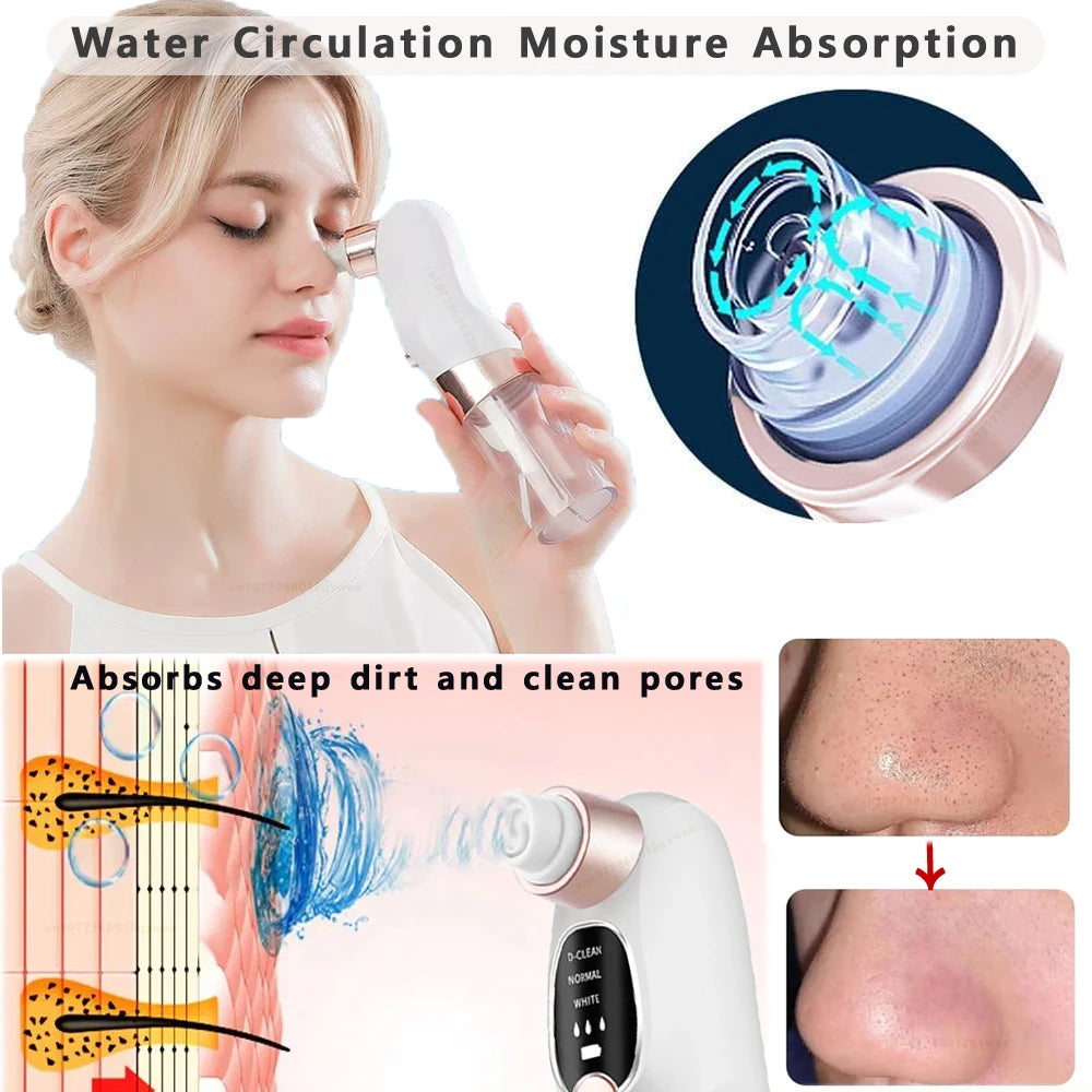 Blackhead Remover Vacuum – USB Rechargeable Pore Cleaner